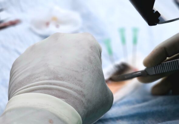 Darované pečene možno biologicky omladiť, tvrdí nový výskum